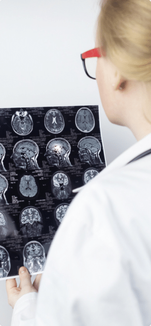 A doctor looking over a scan of the brain