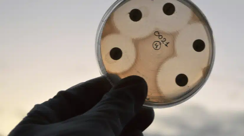 Scientist investigating a bacteria sample